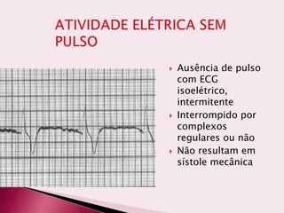  Ausência de pulso
com ECG
isoelétrico,
intermitente
 Interrompido por
complexos
regulares ou não
 Não resultam em
sístole mecânica
 