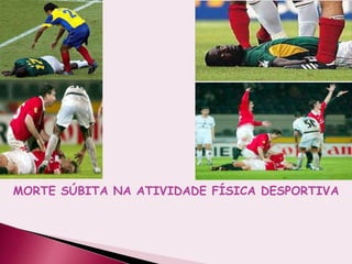 MORTE SÚBITA NA ATIVIDADE FÍSICA DESPORTIVA
 