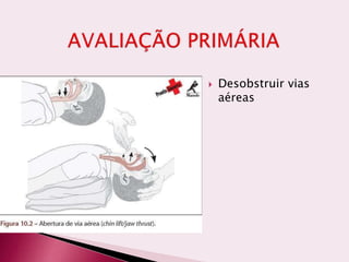  Desobstruir vias
aéreas
 