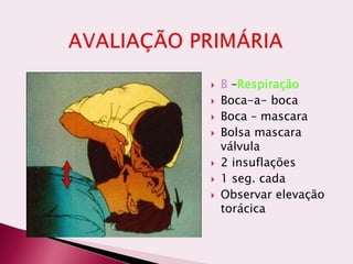  B –Respiração
 Boca-a- boca
 Boca – mascara
 Bolsa mascara
válvula
 2 insuflações
 1 seg. cada
 Observar elevação
torácica
 