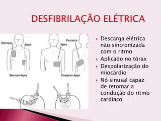  Descarga elétrica
não sincronizada
com o ritmo
 Aplicado no tórax
 Despolarização do
miocárdio
 Nó sinusal capaz
de retomar a
condução do ritmo
cardíaco
 