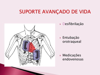  Desfibrilação
 Entubação
orotraqueal
 Medicações
endovenosas
 