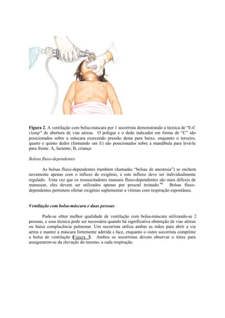 Figura 2. A ventilação com bolsa-máscara por 1 socorrista demonstrando a técnica de "E-C
clamp" de abertura de vias aéreas. O polegar e o dedo indicador em forma de “C” são
posicionados sobre a máscara exercendo pressão desta para baixo, enquanto o terceiro,
quarto e quinto dedos (formando um E) são posicionados sobre a mandíbula para levá-la
para frente. A, lactente; B, criança
Bolsas fluxo-dependentes
As bolsas fluxo-dependentes (também chamadas “bolsas de anestesia”) se enchem
novamente apenas com o influxo de oxigênio, e este influxo deve ser individualmente
regulado. Uma vez que os ressuscitadores manuais fluxo-dependentes são mais difíceis de
manusear, eles devem ser utilizados apenas por pessoal treinado.46
Bolsas fluxo-
dependentes permitem ofertar oxigênio suplementar a vítimas com respiração espontânea.
Ventilação com bolsa-máscara e duas pessoas
Pode-se obter melhor qualidade de ventilação com bolsa-máscara utilizando-se 2
pessoas, e essa técnica pode ser necessária quando há significativa obstrução de vias aéreas
ou baixa complacência pulmonar. Um socorrista utiliza ambas as mãos para abrir a via
aérea e manter a máscara fortemente aderida à face, enquanto o outro socorrista comprime
a bolsa de ventilação (Figura 3). Ambos os socorristas devem observar o tórax para
assegurarem-se da elevação do mesmo, a cada respiração.
 