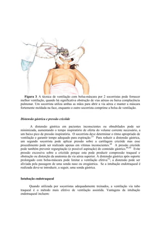 Figura 3. A técnica de ventilação com bolsa-máscara por 2 socorristas pode fornecer
melhor ventilação, quando há significativa obstrução de vias aéreas ou baixa complacência
pulmonar. Um socorrista utiliza ambas as mãos para abrir a via aérea e manter a máscara
fortemente moldada na face, enquanto o outro socorrista comprime a bolsa de ventilação.
Distensão gástrica e pressão cricóide
A distensão gástrica em pacientes inconscientes ou obnubilados pode ser
minimizada, aumentando o tempo inspiratório de oferta do volume corrente necessário, a
um baixo pico de pressão inspiratória. O socorrista deve determinar o ritmo apropriado de
ventilação e garantir tempo adequado para expiração.25
Para reduzir a distensão gástrica,
um segundo socorrista pode aplicar pressão sobre a cartilagem cricóide mas esse
procedimento pode ser realizado apenas em vítimas inconscientes.48
A pressão cricóide
pode também prevenir regurgitação (e possível aspiração) do conteúdo gástrico.49,50
Evite
pressão excessiva sobre a cricóide porque esta pode produzir compressão traqueal e
obstrução ou distorção da anatomia da via aérea superior. A distensão gástrica após suporte
prolongado com bolsa-máscara pode limitar a ventilação efetiva52
; a distensão pode ser
aliviada pela passagem de uma sonda naso ou orogástrica. Se a intubação endotraqueal é
realizada deve-se introduzir, a seguir, uma sonda gástrica.
Intubação endotraqueal
Quando utilizada por socorristas adequadamente treinados, a ventilação via tubo
traqueal é o método mais efetivo de ventilação assistida. Vantagens da intubação
endotraqueal incluem:
 