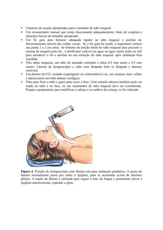 • Cateteres de sucção apropriados para o tamanho do tubo traqueal.
• Um ressuscitador manual que esteja funcionando adequadamente, fonte de oxigênio e
máscaras faciais de tamanho apropriado.
• Um fio guia para fornecer adequada rigidez ao tubo traqueal e auxiliar no
direcionamento através das cordas vocais. Se o fio guia for usado, é importante colocar
sua ponta 1 a 2 cm antes do término da porção distal do tubo traqueal para prevenir o
trauma da traquéia pelo fio. Lubrificante solúvel em água ou água estéril pode ser útil
para umedecer o fio e auxiliar na sua remoção do tubo traqueal, após intubação bem
sucedida.
• Três tubos traqueais, um tubo do tamanho estimado e tubos 0,5 mm maior e 0,5 mm
menor. Lâmina de laringoscópio e cabo com lâmpada forte (e lâmpada e baterias
reservas).
• Um detetor de CO2 exalado (capnógrafo ou colorimétrico) ou, em crianças mais velhas
e adolescentes um tubo detetor esofágico.
• Fitas para fixar o tubo e gases para secar a face. Uma solução adesiva também pode ser
usada no tubo e na face, ou um sustentador de tubo traqueal deve ser considerado.
Prepare equipamento para imobilizar a cabeça e os ombros da criança, se for indicado.
Figura 4. Posição do laringoscópio com lâmina reta para intubação pediátrica. A ponta da
lâmina normalmente passa por sobre a epiglote, para se acomodar acima da abertura
glótica. A tração da lâmina é utilizada para erguer a base da língua e juntamente elevar a
epiglote anteriormente, expondo a glote.
 