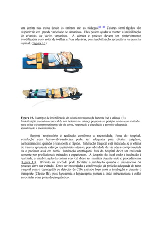 um coxim nas costa desde os ombros até as nádegas.98 99
Colares semi-rígidos são
disponíveis em grande variedade de tamanhos. Eles podem ajudar a manter a imobilização
de crianças de vários tamanhos. A cabeça e pescoço devem ser posteriormente
imobilizados com rolos de toalhas e fitas adesivas, com imobilização secundária na prancha
espinal. (Figura 10).
Figura 10. Exemplo de imobilização de coluna no trauma de lactente (A) e criança (B).
Imobilização da coluna cervical de um lactente ou criança pequena em posição neutra com cuidado
para evitar o comprometimento da via aérea, respiração e circulação e permitir adequada
visualização e monitorização.
Suporte respiratório é realizado conforme a necessidade. Fora do hospital,
ventilação com bolsa-valva-máscara pode ser adequada para ofertar oxigênio,
particularmente quando o transporte é rápido. Intubação traqueal está indicada se a vítima
de trauma apresenta esforço respiratório intenso, perviabilidade da via aérea comprometida
ou o paciente está em coma. Intubação orotraqueal fora do hospital deve ser realizada
somente por profissionais treinados e experientes. A despeito do local onde a intubação é
realizada, a imobilização da coluna cervical deve ser mantida durante todo o procedimento
(Figura 11). Pressão na cricóide pode facilitar a intubação quando o movimento do
pescoço deve ser evitado. Deve ser encorajada a confirmação da posição adequada do tubo
traqueal com o capnográfo ou detector de CO2 exalado logo após a intubação e durante o
transporte (Classe IIa), pois hipoxemia e hipercapnia pioram a lesão intracraniana e estão
associadas com piora do prognóstico.
 