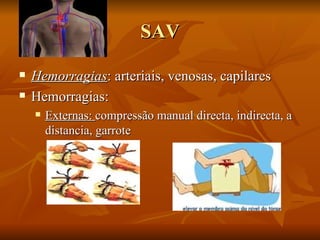 SAV Hemorragias : arteriais, venosas, capilares Hemorragias:  Externas:  compressão manual directa, indirecta, a distancia, garrote 