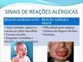 SINAIS DE REAÇÕES ALÉRGICAS
REAÇÃO ALÉRGICA LEVE REAÇÃO ALÉRGICA
GRAVE
• Nariz inchado, espirros e
coceira ao redor dos olhos.
• Coceira na pele.
• Erupções vermelhas e
elevadas na pele (urticária).
• Dificuldade para respirar.
• Inchaço da língua e da face.
• Desmaio.
 
