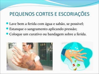 PEQUENOS CORTES E ESCORIAÇÕES
Lave bem a ferida com água e sabão, se possível;
Estanque o sangramento aplicando pressão;
Coloque um curativo ou bandagem sobre a ferida.
 