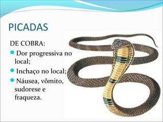 PICADAS
DE COBRA:
Dor progressiva no
local;
Inchaço no local;
Náusea, vômito,
sudorese e
fraqueza.
 