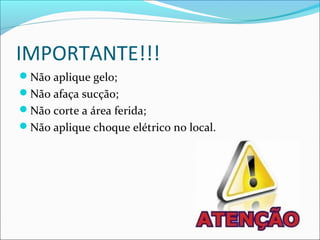 IMPORTANTE!!!
Não aplique gelo;
Não afaça sucção;
Não corte a área ferida;
Não aplique choque elétrico no local.
 