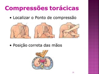 Compressões torácicas
 • Localizar o Ponto de compressão




 • Posição correta das mãos




                                26
 