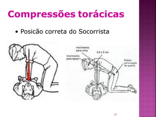 Compressões torácicas
 • Posicão correta do Socorrista




                                   28
 