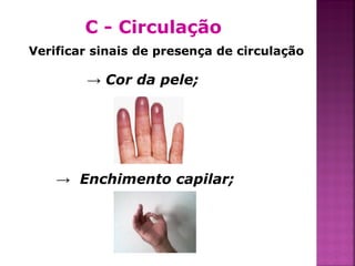 C - Circulação
Verificar sinais de presença de circulação

        → Cor da pele;




    → Enchimento capilar;




                                             31
 