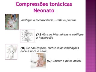 Compressões torácicas
     Neonato
 Verifique a inconsciência - reflexo plantar




             (A) Abra as Vias aéreas e verifique
             a Respiração


 (B) Se não respira, efetue duas insuflações
 boca a boca e nariz.


                     (C) Checar o pulso apical


                                                   33
 