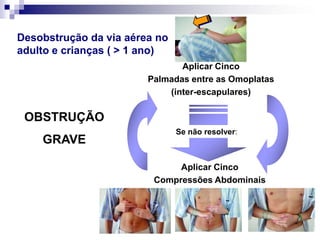 2.5 – ACTUAÇÃO NO CASO DE PRESENÇA DE 				CORPOS ESTRANHOSOUVIDOQuer se trate de um insecto ou corpo estranho não tente remove-lo.				    Enviar ao hospital.