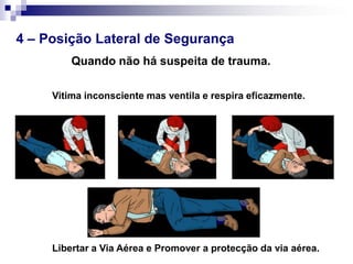 3 – OBSTRUCÇÃO DA VIA AÉREAA maioria das situações de obstrução da via aérea ocorrem durante a ingestão de alimentos e muitas vezes presenciadas.OBSTRUÇÃO LIGEIRAOBSTRUÇÃO GRAVE