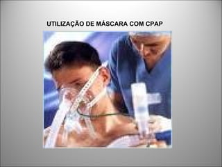 UTILIZAÇÃO DE MÁSCARA COM CPAP
 