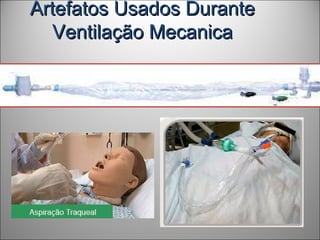 Artefatos Usados DuranteArtefatos Usados Durante
Ventilação MecanicaVentilação Mecanica
 