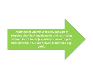 Treatment of vitamin A toxicity consists of
stopping vitamin A supplements and restricting
vitamin A-rich foods (especially sources of pre-
formed vitamin A, such as liver, kidney and egg
yolk).
 