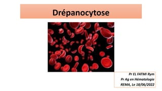Drépanocytose
Pr EL FATMI Rym
Pr Ag en Hématologie
REMA, Le 18/06/2022
 