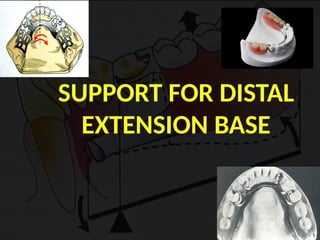 Distal Extension In removable partial denture | PPTX