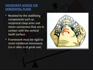 Distal Extension In removable partial denture | PPTX