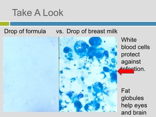 Take A Look
Drop of formula vs. Drop of breast milk
White
blood cells
protect
against
infection.
Fat
globules
help eyes
and brain
 