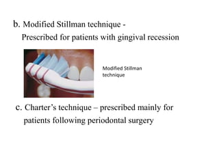 b. Modified Stillman technique -
Prescribed for patients with gingival recession
c. Charter’s technique – prescribed mainly for
patients following periodontal surgery
Modified Stillman
technique
 
