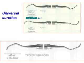 Universal
curettes
 