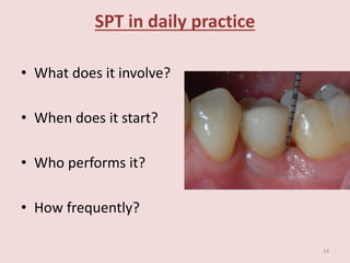SPT in daily practice
• What does it involve?
• When does it start?
• Who performs it?
• How frequently?
14
 
