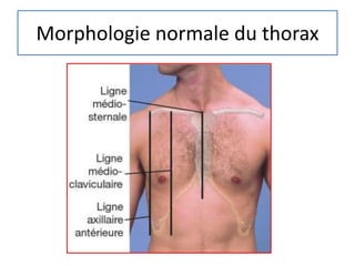 Morphologie normale du thorax
 