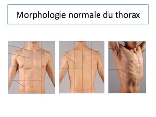 Morphologie normale du thorax
 