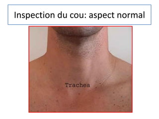 Inspection du cou: aspect normal
 