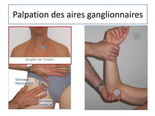 Palpation des aires ganglionnaires
 