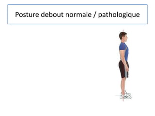 Posture debout normale / pathologique
 