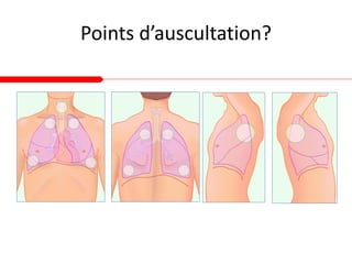 Points d’auscultation?
 
