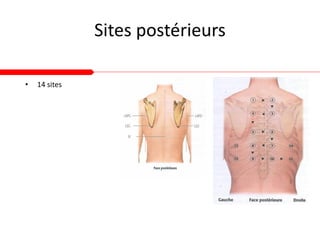 Sites postérieurs
• 14 sites
 