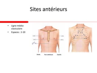 Sites antérieurs
• Ligne médio-
claviculaire
• Espaces : 1-10
 