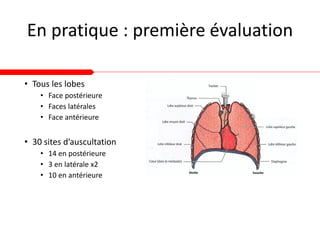 En pratique : première évaluation
• Tous les lobes
• Face postérieure
• Faces latérales
• Face antérieure
• 30 sites d’auscultation
• 14 en postérieure
• 3 en latérale x2
• 10 en antérieure
 