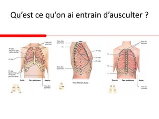 Qu’est ce qu’on ai entrain d’ausculter ?
 