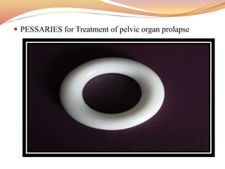  PESSARIES for Treatment of pelvic organ prolapse
 