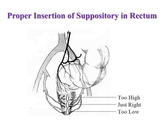 Proper Insertion of Suppository in Rectum
 