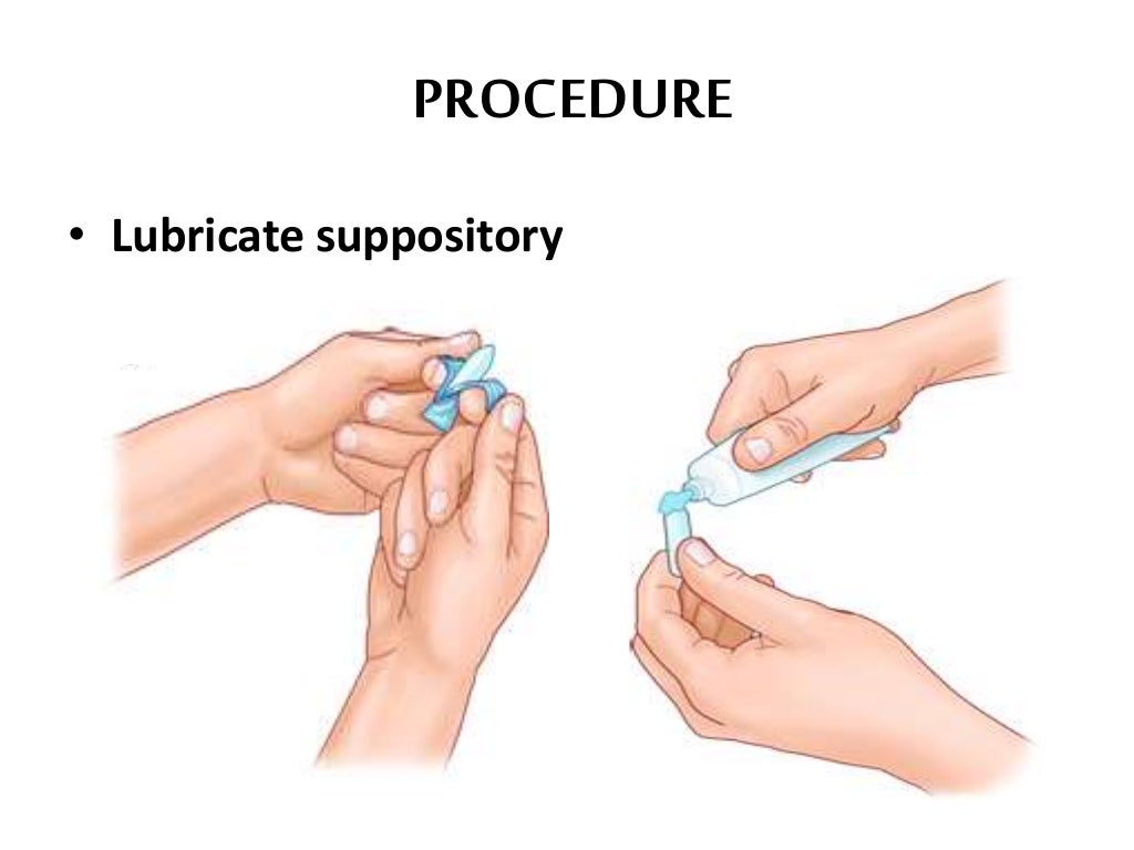 Suppository Suppository