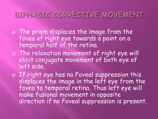  The prism displaces the image from the
fovea of right eye towards a point on a
temporal half of the retina.
 The relaxation movement of right eye will
elicit conjugate movement of both eye of
left side.
 If right eye has no Foveal suppression this
displaces the image in the left eye from the
fovea to temporal retina. Thus left eye will
make fusional movement in opposite
direction if no Foveal suppression is present.
 