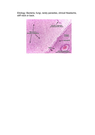 Etiology: Bacteria, fungi, rarely parasites, clinical Headache,
stiff neck or back.
 