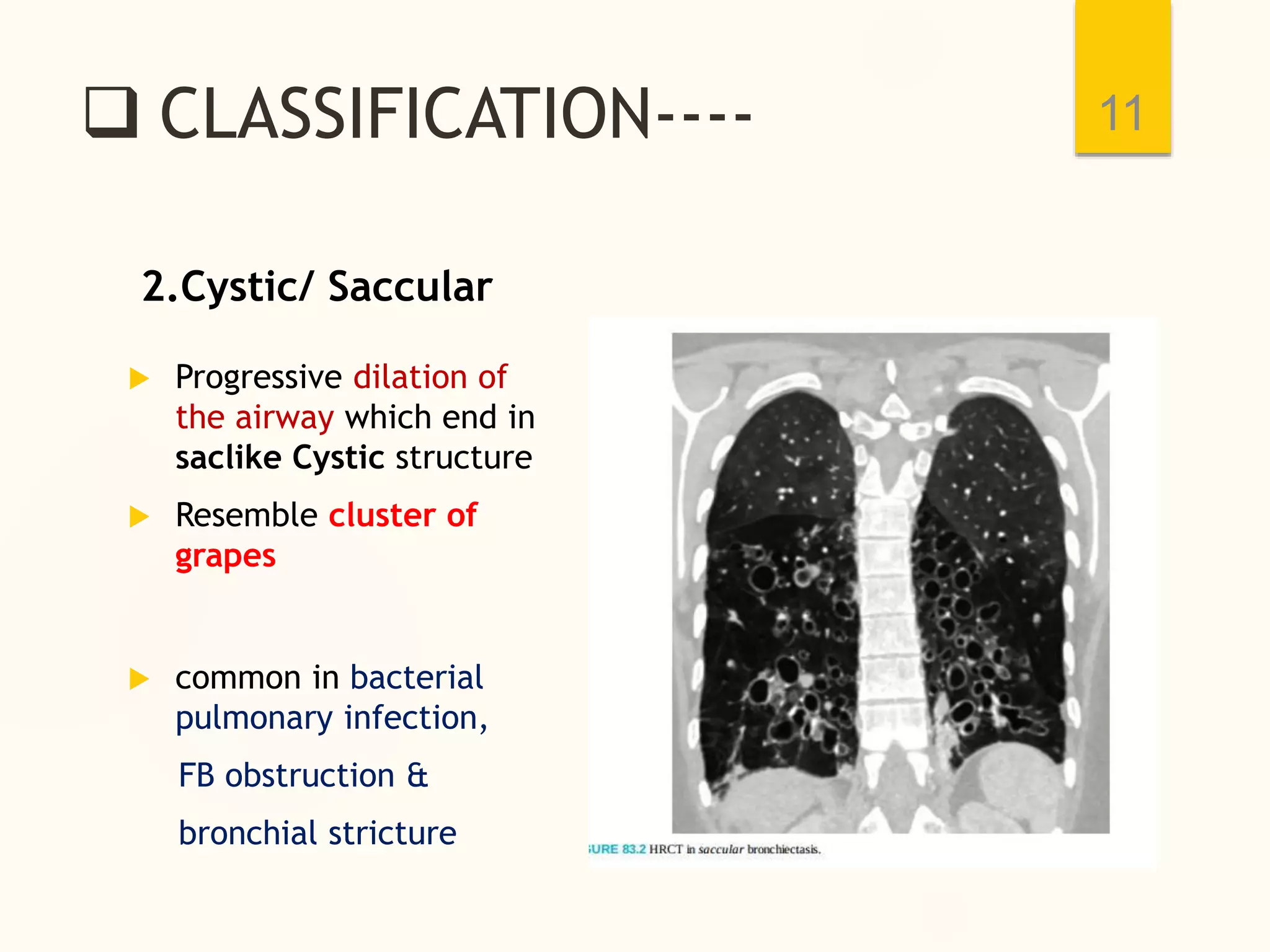  CLASSIFICATION----
2.Cystic/ Saccular
 Progressive dilation of
the airway which end in
saclike Cystic structure
 Resemble cluster of
grapes
 common in bacterial
pulmonary infection,
FB obstruction &
bronchial stricture
11
 