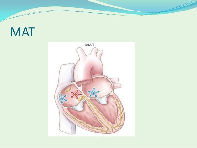 Drugs for supraventricular tachycardia