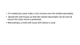 • If a medial pin used, make a 1cm incision over the medial epicondyle.
• Spread the soft tissues so that the medial epicondyle can be seen &
ensure the ulnar nerve is protected.
• Alternatively, a small soft tissue drill sleeve is used.
 