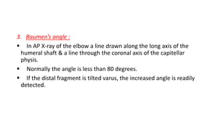 3. Baumen’s angle :
 In AP X-ray of the elbow a line drawn along the long axis of the
humeral shaft & a line through the coronal axis of the capitellar
physis.
 Normally the angle is less than 80 degrees.
 If the distal fragment is tilted varus, the increased angle is readily
detected.
 